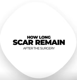 How Long Scar Remaın After The Surgery ?