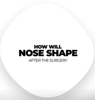 How Will Nose Shape After The Surgery ?